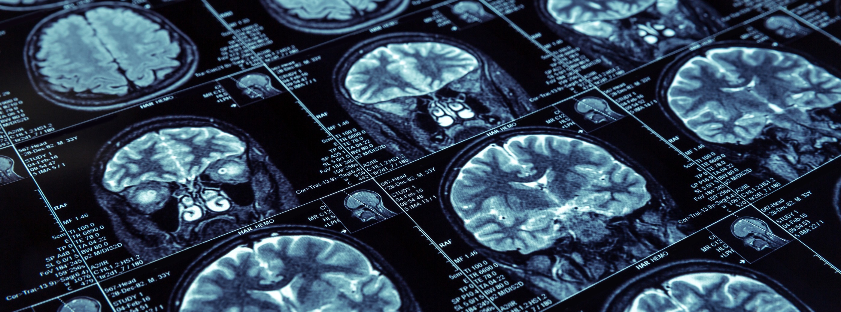 Stock image of magnetic resonance image results